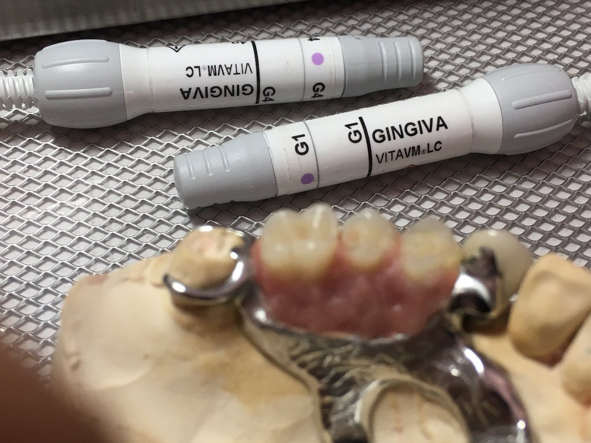 Ernesto_VITA's tweet photo. Working on Removable Prosthesis
#removible #vitacadcam #vm13 #dental #bego #wironit #attachment #vitamft #vmlc #vmlcgingiva https://t.co/uDtrypceMz