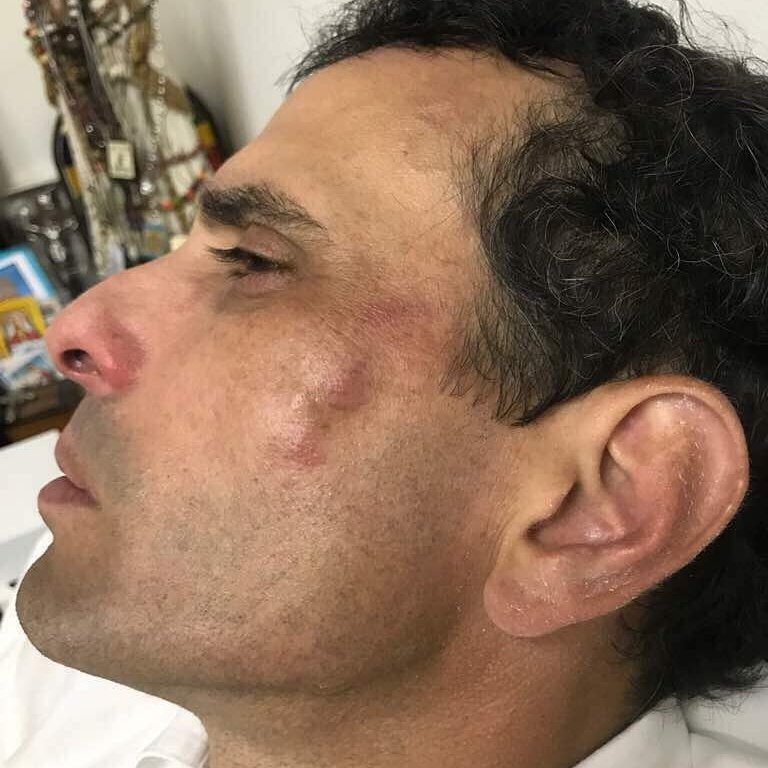 JulioBorges's tweet photo. Solidaridad con @hcapriles y su equipo tras ser heridos, golpeados​ y robados​ en las Mercedes https://t.co/yE4Jqfi9SP