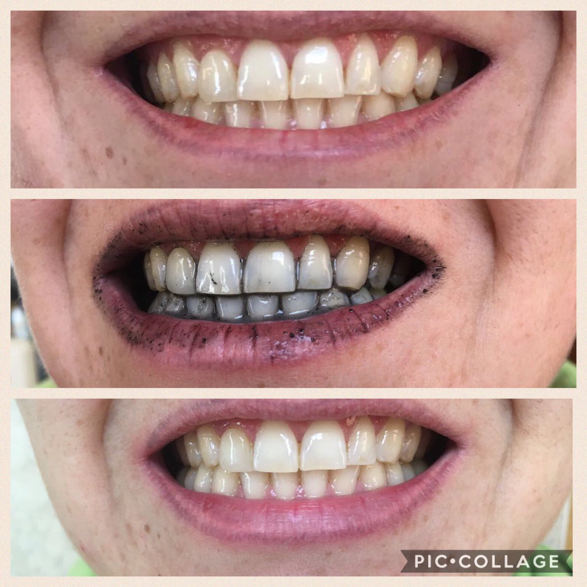 orbellmx's tweet photo. Ya tienes tu #dentaldetox ? Cómpralo por $250 pesos https://t.co/guapEP0p2b #shoponline #dientesblancos #naturalmente #hotsale https://t.co/soYnMImN35