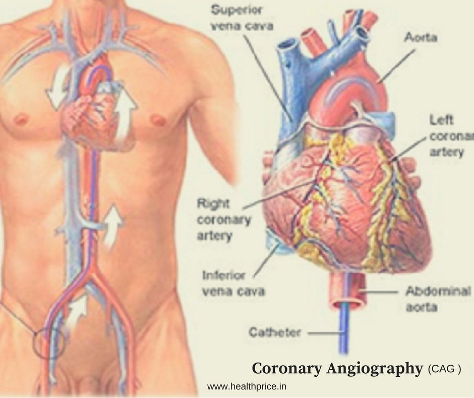 chanchal_bh's tweet photo. Do you know what is Angiography ?
https://t.co/Ad4r8S8AV5
#Angiography https://t.co/lZxJOodMR9