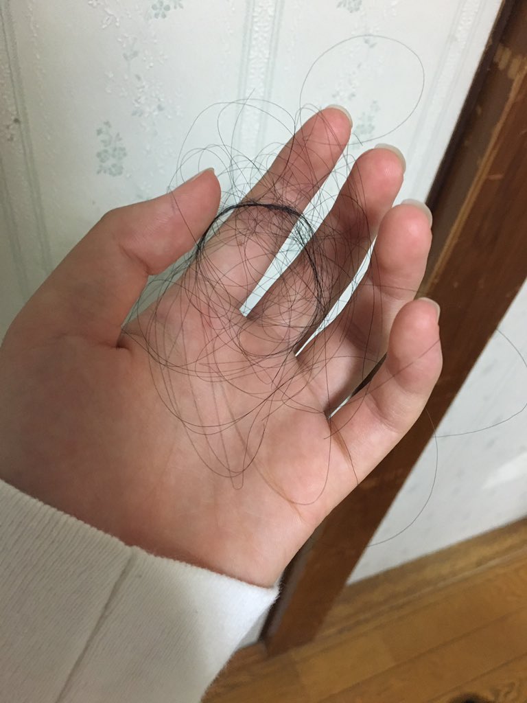 きむ 最近 抜け毛が酷いんです