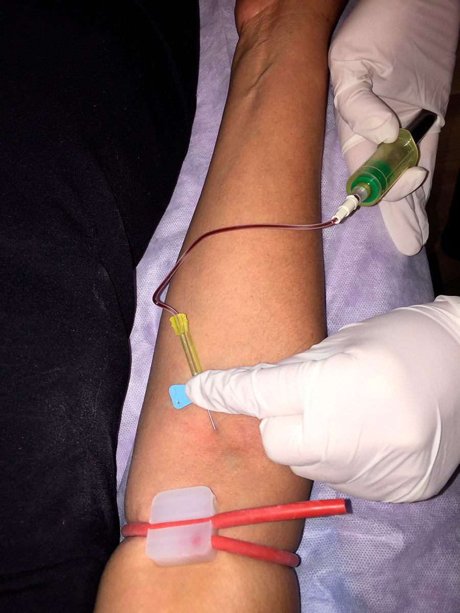 ConoceMas_GZ's tweet photo. ¿Qué es el Plasma Rico en Plaquetas? https://t.co/swoJ6yGXNb https://t.co/GaCnTRNxiY