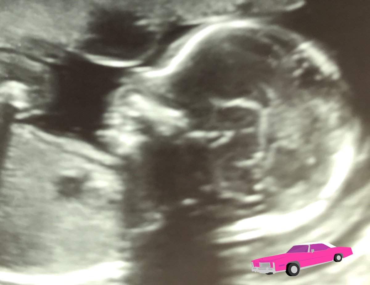 CoachMoffett's tweet photo. Lincoln is getting a baby sister!!!!! 💕🎀🛍💋💅🏼👧🏼🌺🍭👠👗 https://t.co/2esPk1vFKp
