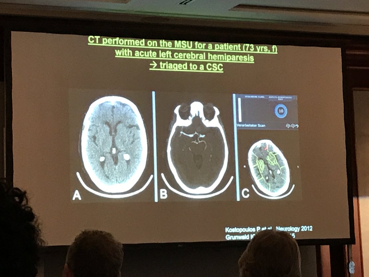 Brainomix's tweet photo. 'TIME IS BRAIN' was the central message @EuropeanStrokeAssociation 
May 2017 conference. https://t.co/7MB1t3HA4z