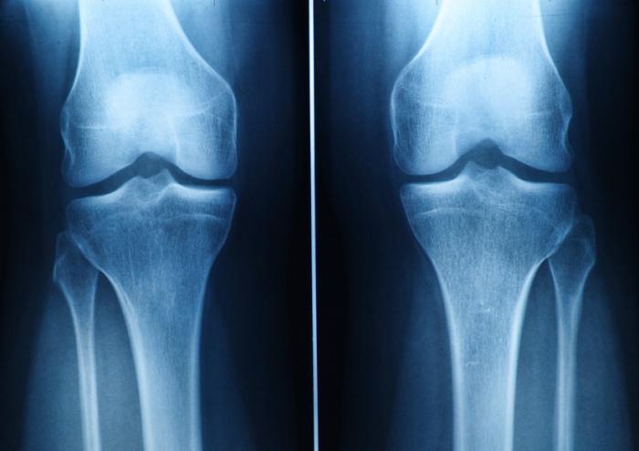 Indian Institute of Technology's 3D printed silk cartilage helps activate organ growth - bit.ly/2rgoOHj - #3dprinting