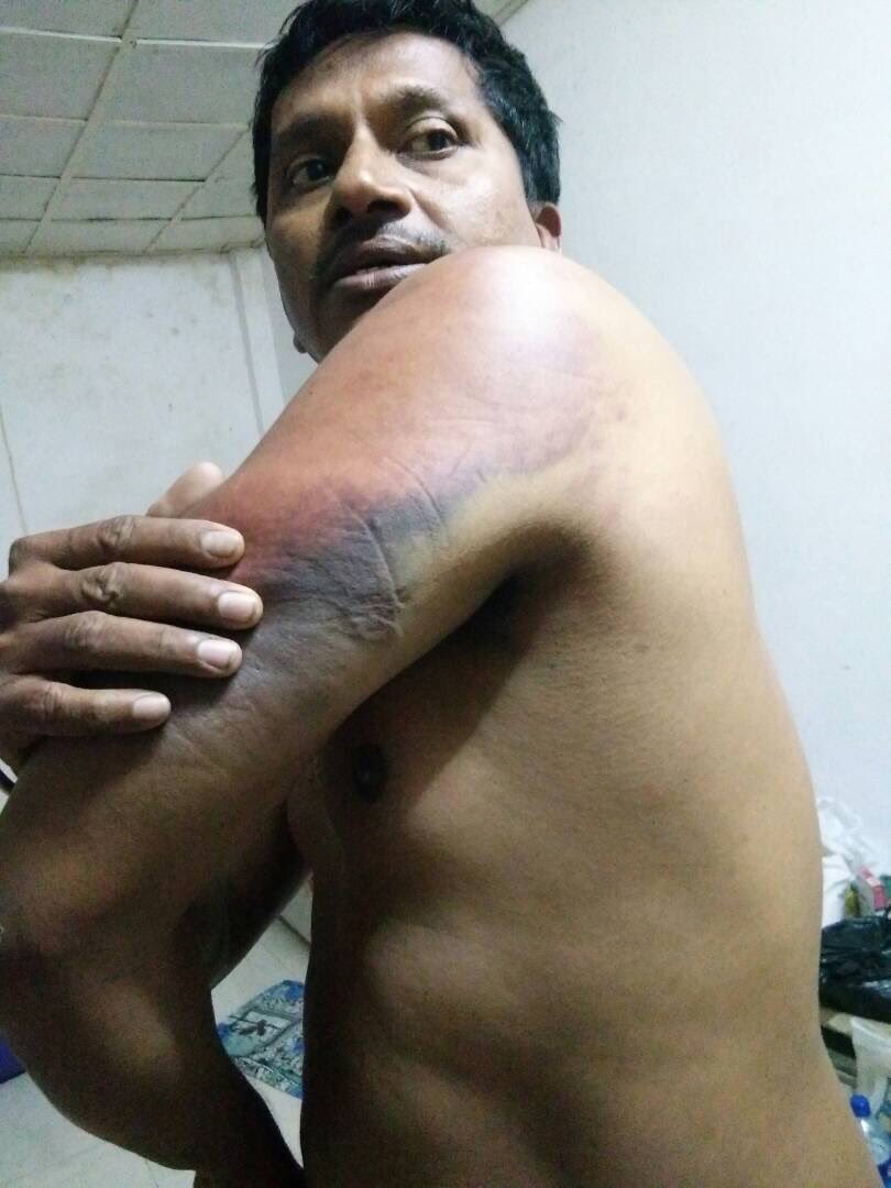 karlgomes's tweet photo. #Help Indian stuck in Mozambique. Beaten daily to extort money. @sushmaswaraj @narendramodi and @IndiaInMoz #PleaseRT https://t.co/BWywS5sQdx