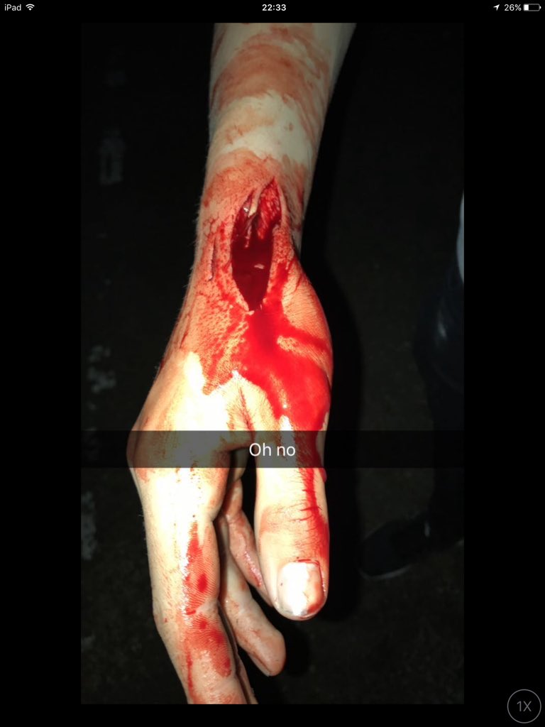 JimmyTWaters's tweet photo. @TGFbro watch out for the razor wire. Was here on Saturday night ✌🏻 https://t.co/Iu8xzoLpsR