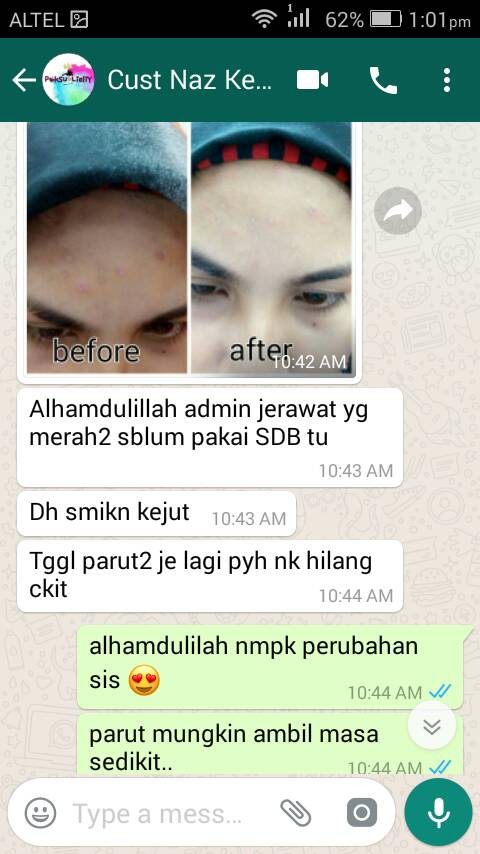 SheilaDBeauty's tweet photo. Hakak2, hadik2, abam2 jangan buat admin terkejut tau 😱
#sheiladbeauty https://t.co/bojHCOY577