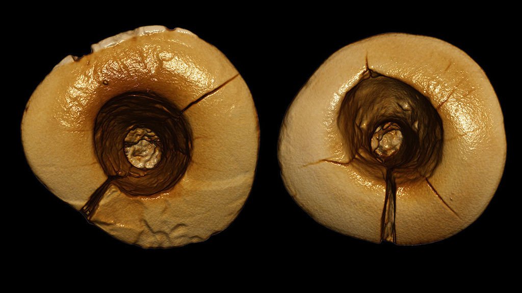 oralthbcn's tweet photo. El empaste #dental más antiguo conocido: hecho con plantas en la Italia de hace 13.000 años https://t.co/O2ldAfKBTA vía @elespanolcom #salud https://t.co/AfPnaDxmkl