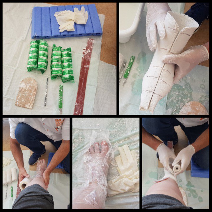 Imzadi139's tweet photo. It's #WorldMSDay today. And, how appropriate, I was fitted for orthopedic shoes. Hoping it will help me walk better! #worldmsday2017 https://t.co/6JdQGPpGtt
