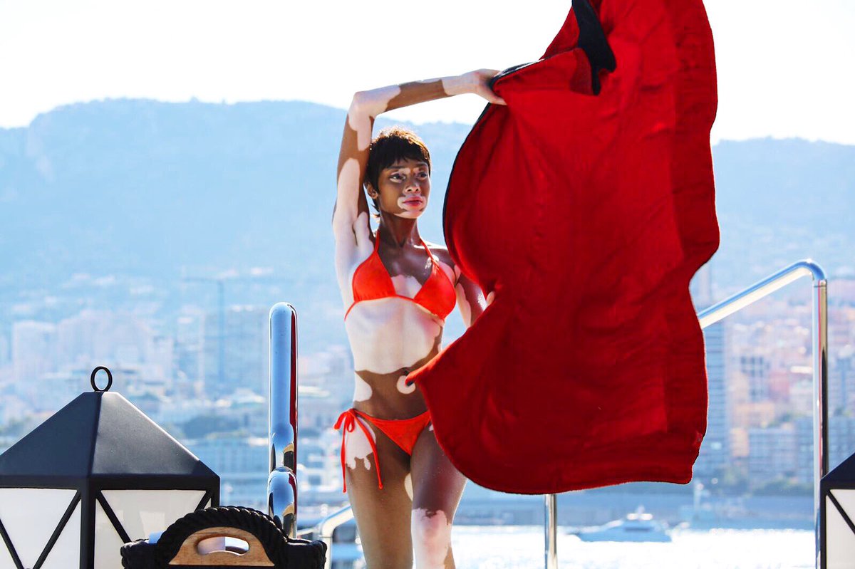 Резултат с изображение за winnie harlow