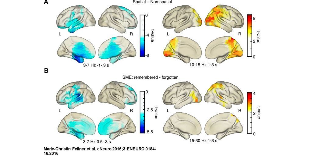 SfNtweets's tweet photo. Read the results of a study exploring memory encoding: https://t.co/AfciXIogks https://t.co/nurgtngTY0