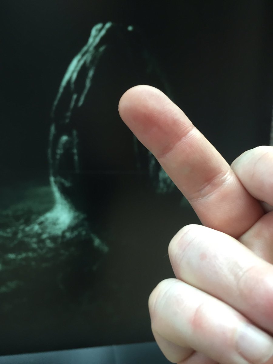 AltAngleFilms's tweet image. Short, controlled outbursts.