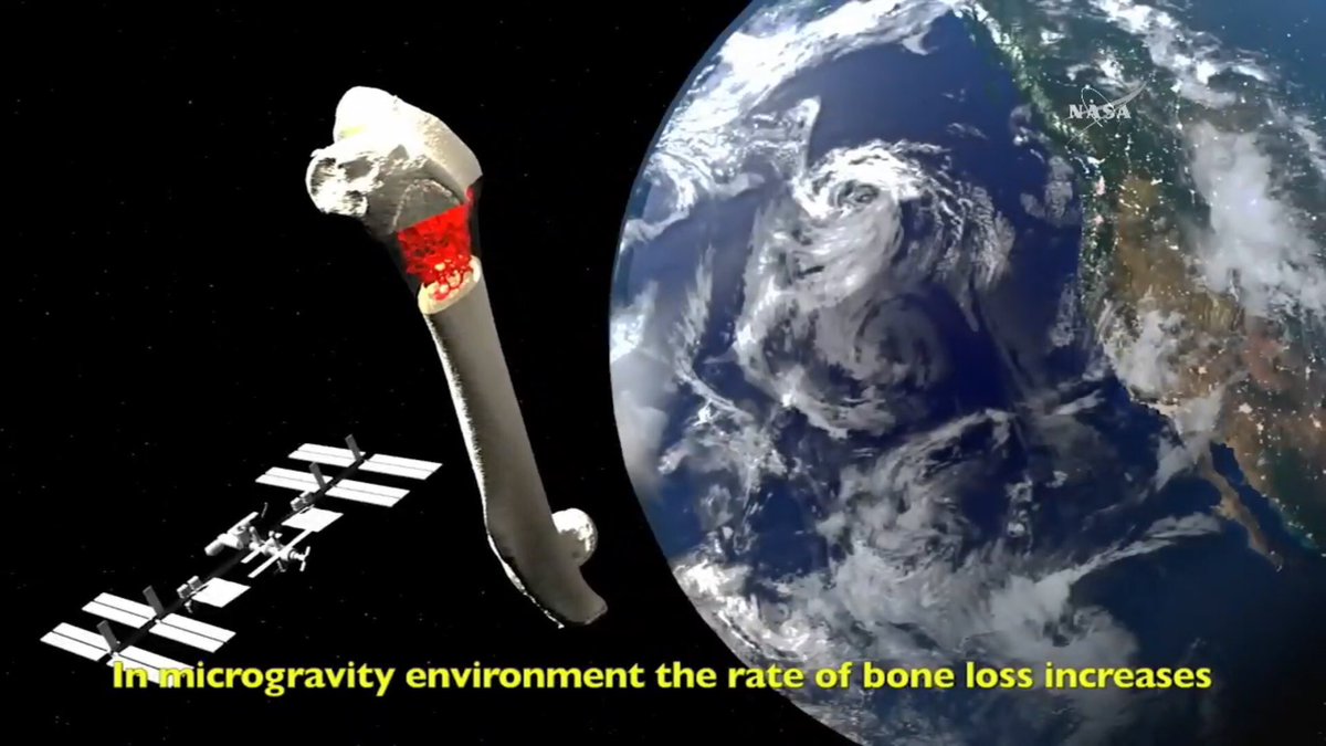 AstroMiceRule's tweet photo. To learn more about the investigation lead by Dr. Soo, MD
please read this:
https://t.co/PpZF0EryxG
#AstroMiceRule #Osteoporosis #NELL1 🐭🔬⚗️ https://t.co/L03jCbwep6