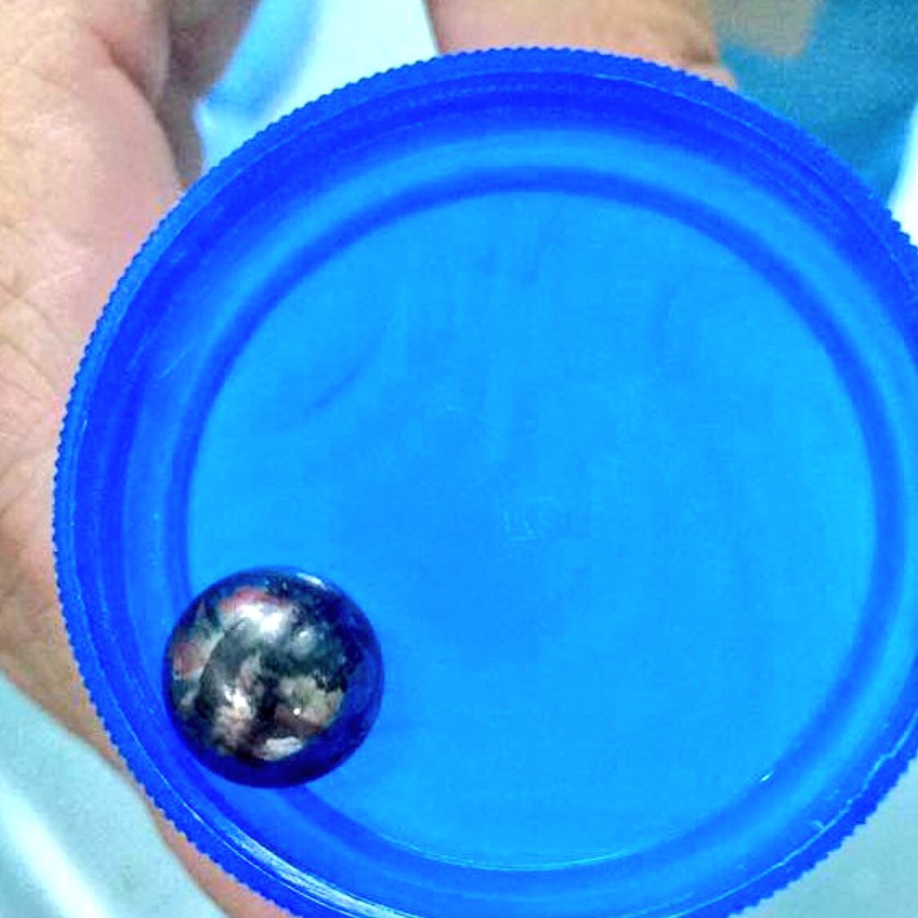 eliasayegh's tweet image. Yonel Pestana (18 años) fue intervenido, gracias a Dios se encuentra estable y esta recuperándose.