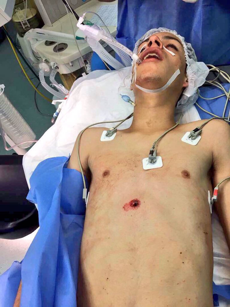 eliasayegh's tweet image. Yonel Pestana (18 años) fue intervenido, gracias a Dios se encuentra estable y esta recuperándose.