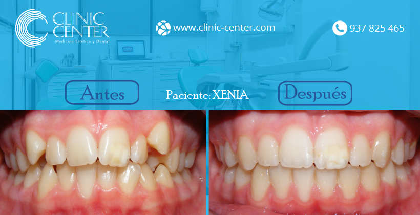 ClinicCenterBCN's tweet photo. Nuestros pacientes, muy satisfechos con su paso por #Clinic_Center
¡Pide cita en nuestra clínica dental! https://t.co/jpZQAY0j6k