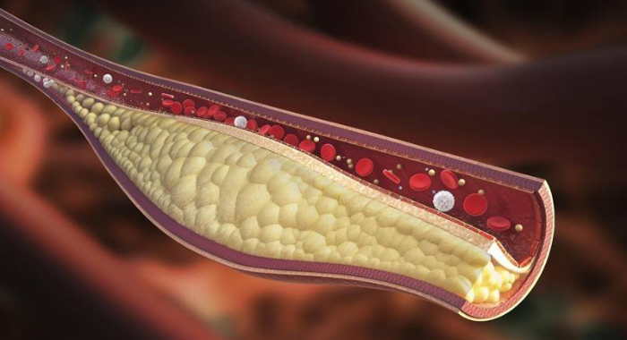 chanchal_bh's tweet photo. What are lipids? Why are they important?
https://t.co/Ii3xM3Yoji
#lipidProfile https://t.co/C9F3nke9r4
