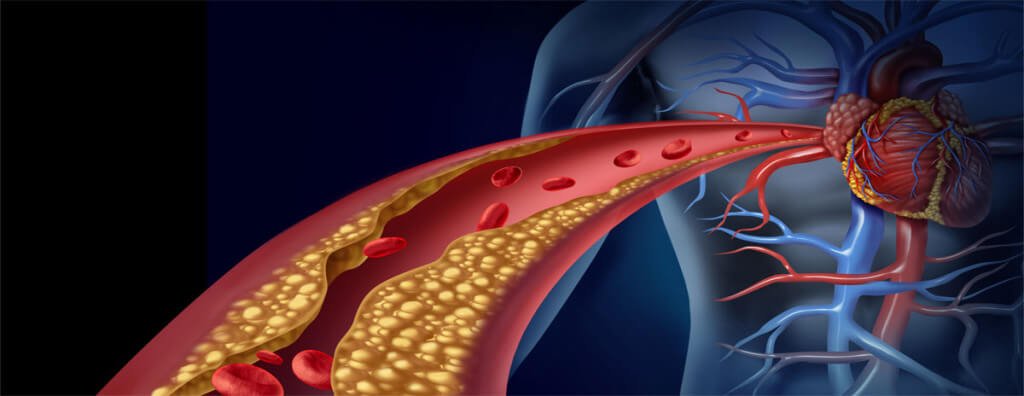 What’s The Difference Between Cholesterol And Triglycerides? >>> bit.ly/2c20uAe
