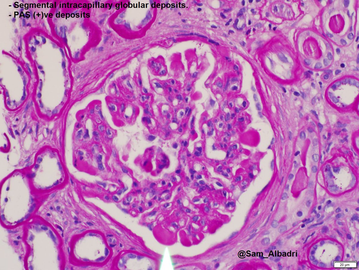 Nephrology FTP (Nephrology_FTP) Twitter
