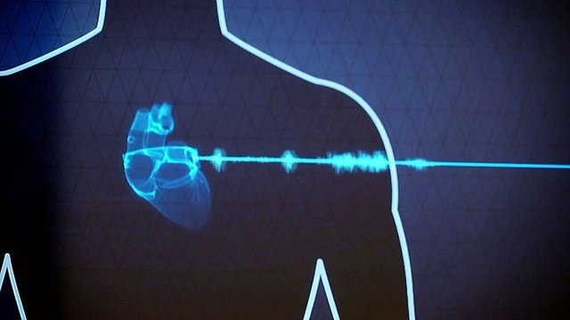 California company, Forward, is launching a #healthscan that uses #artificialintelligence bit.ly/2ruc41X