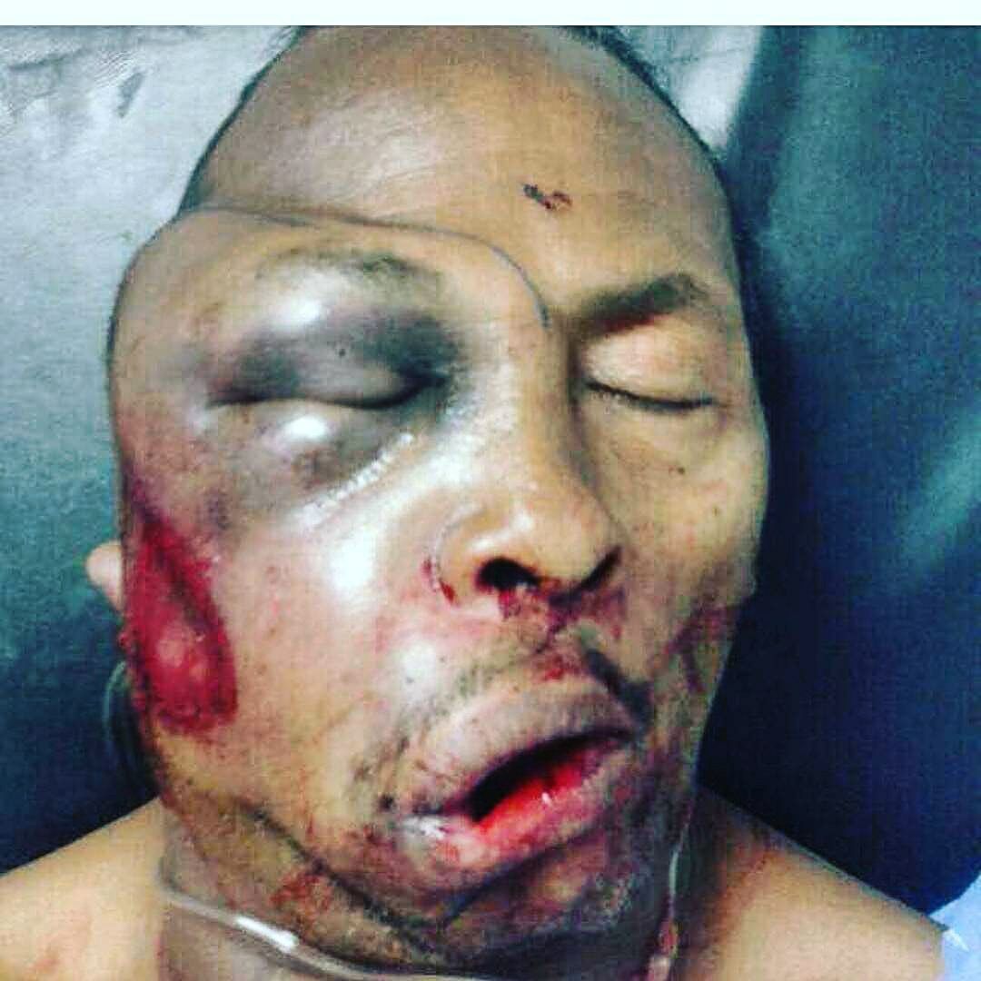 CboboSeRespeta's tweet photo. #1Jun Esta imagen es otra prueba de la brutal represión que se vive en Vzla, Policía Nacional le disparo una bomba lacrimogena en el rostro https://t.co/bZqW73rut9