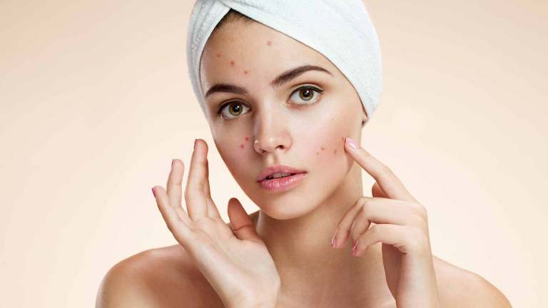 Yougoz's tweet photo. #YNTK You need to know these five #healthy homemade facemasks that will pamper your skin. #DIY
 https://t.co/kysK1clNhv https://t.co/nckFAwgc0T