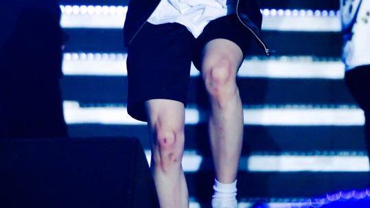 olyoongo's tweet image. a yoongi's bruised knees appreciation post