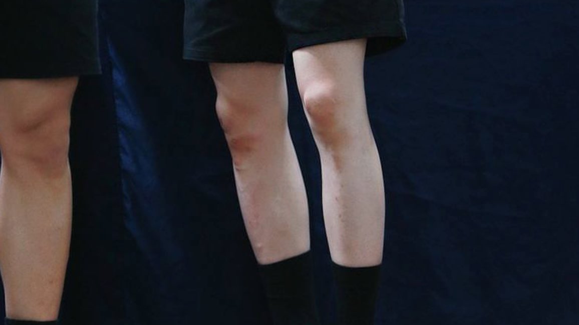 olyoongo's tweet image. a yoongi's bruised knees appreciation post