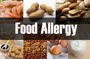 Cara Jitu Mengobati Alergi Makanan …mulutsurabaya.klinikmetamorphosis.com/wp/cara-jitu-m…