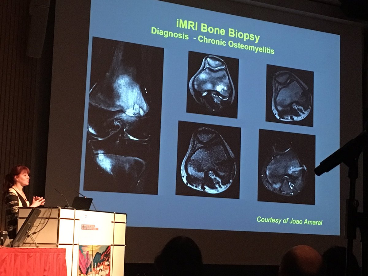 Premal__Patel's tweet photo. Dr Cahill from @ChildrensPhila talking about Innovative Imaging in #PedsIR @socpedsir at #ESPR2017 - ultrasound contrast, fusion and more. https://t.co/cQihl05RBi
