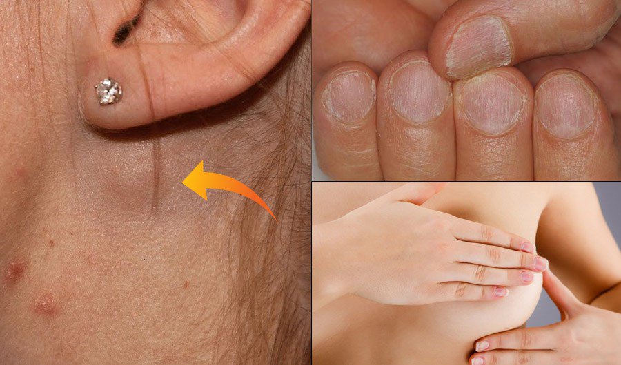 SEE 15 EARLY WARNING SIGNS OF CANCER WOMEN NEED TO BE AWARE OF SEE 15 EARLY WARNING SIGNS OF CANCER WOMEN NEED TO BE AWARE OF
