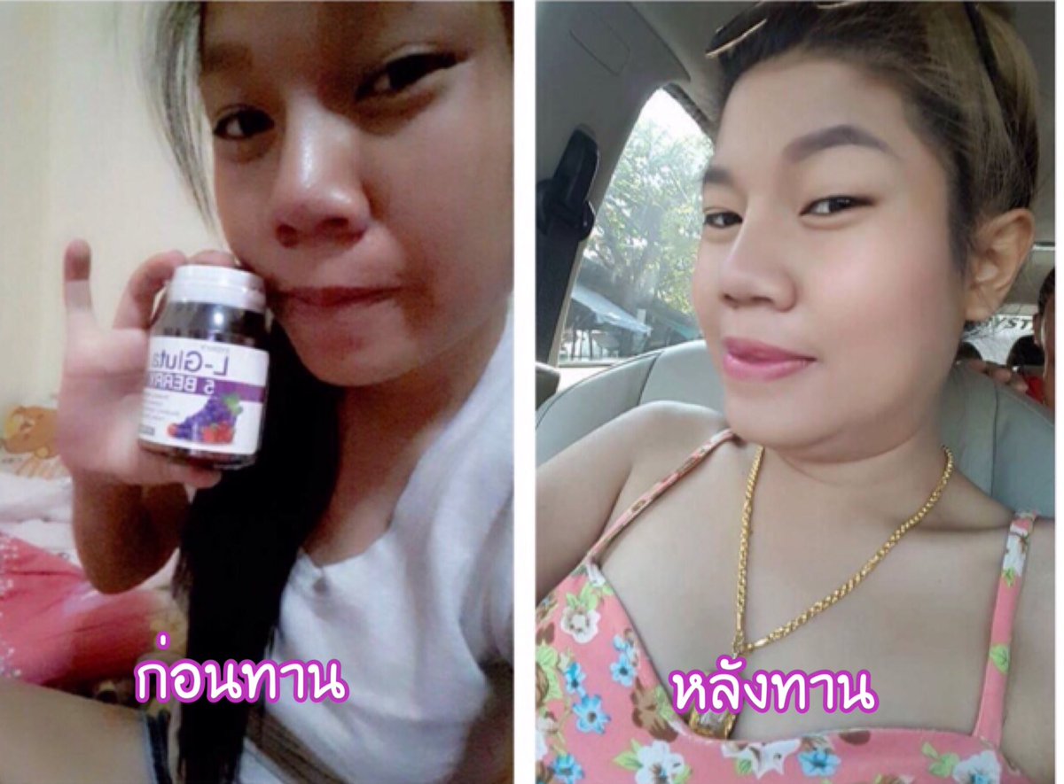 Sayhishopone's tweet photo. ทานจริงเห็นผลจริง รีวิวเพียบ #ชิดนี้ย์ #sydney #gluta #5berry  #ใช้ดีบอกต่อ #ของถูกบอกต่อ #howtoperfect #sydneygluta5berry https://t.co/yvO1BZEulL
