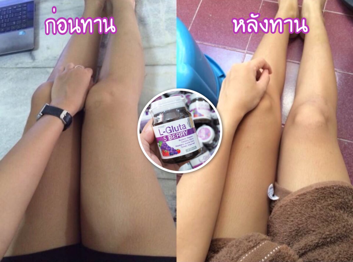 Sayhishopone's tweet photo. ทานจริงเห็นผลจริง รีวิวเพียบ #ชิดนี้ย์ #sydney #gluta #5berry  #ใช้ดีบอกต่อ #ของถูกบอกต่อ #howtoperfect #sydneygluta5berry https://t.co/yvO1BZEulL