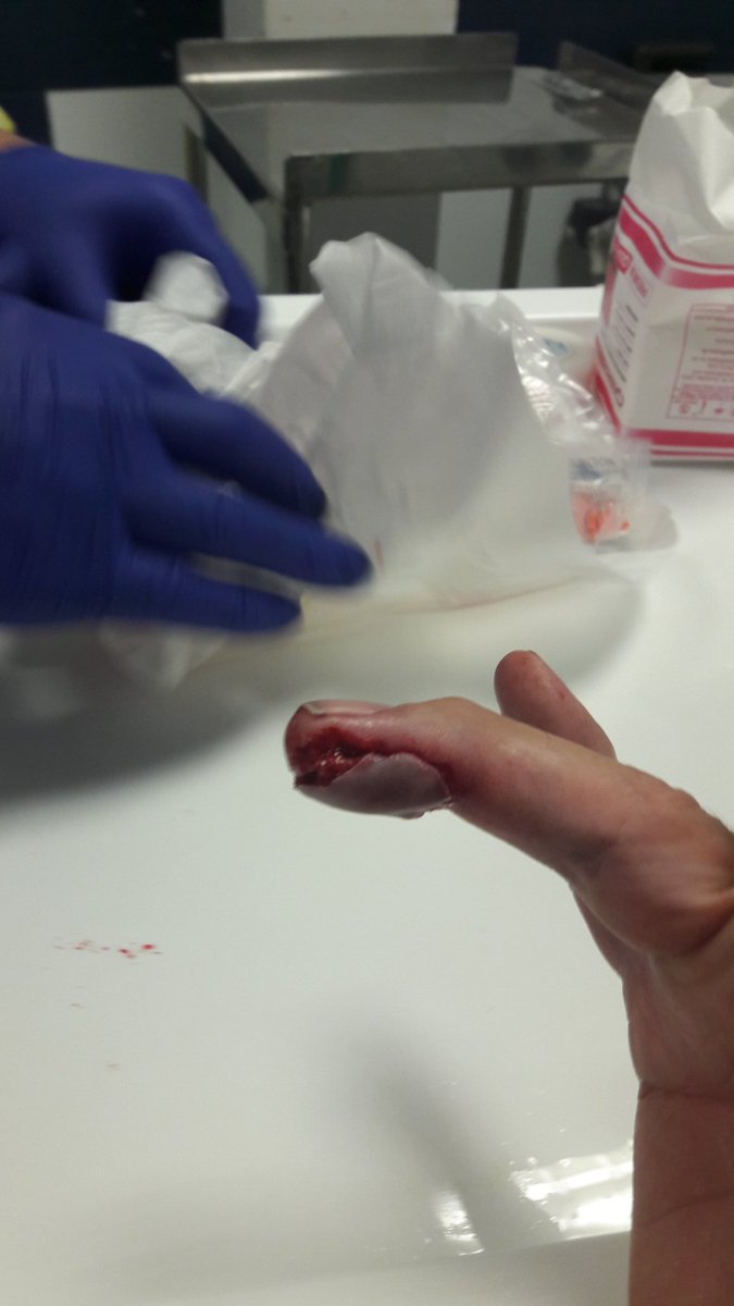 StevePepp's tweet photo. Oooouch πππ https://t.co/s6l9uaDHKU