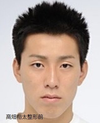 I Web 高畑裕太 整形疑惑までも浮上 突然くっきり二重にチェンジ 画像あり