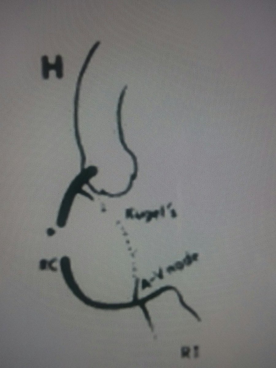 TheDocNeverDies's tweet photo. #cardiofreak Arteria de Kugel: rama entre la CD o Cx proximal y la rama del nodoAV. Recorre la zona basal del septo interauricular https://t.co/zMOzfrGOhq