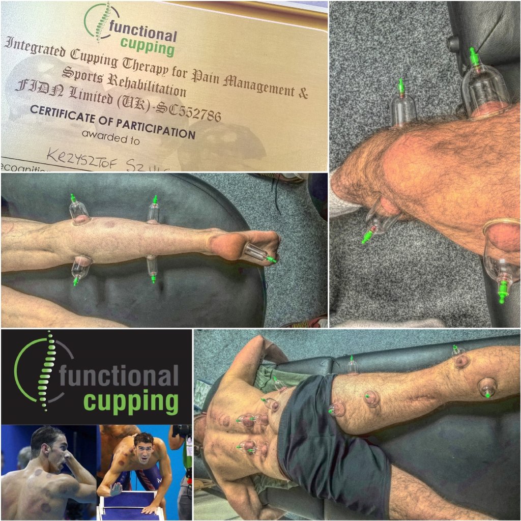 KrisMassage's tweet photo. #integral #cupping #Glasgow @krismassage #45min -£30 https://t.co/kAchKBUQQr