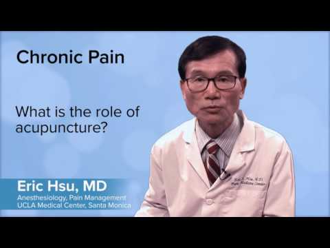 AcupunctureCNet's tweet photo. #acupuncture What is the role of acupuncture? - Eric S.Z. Hsu, MD | UCLA Pain Center - https://t.co/TpZTBNFVoz #RT #Retweet https://t.co/E9rj80zgul