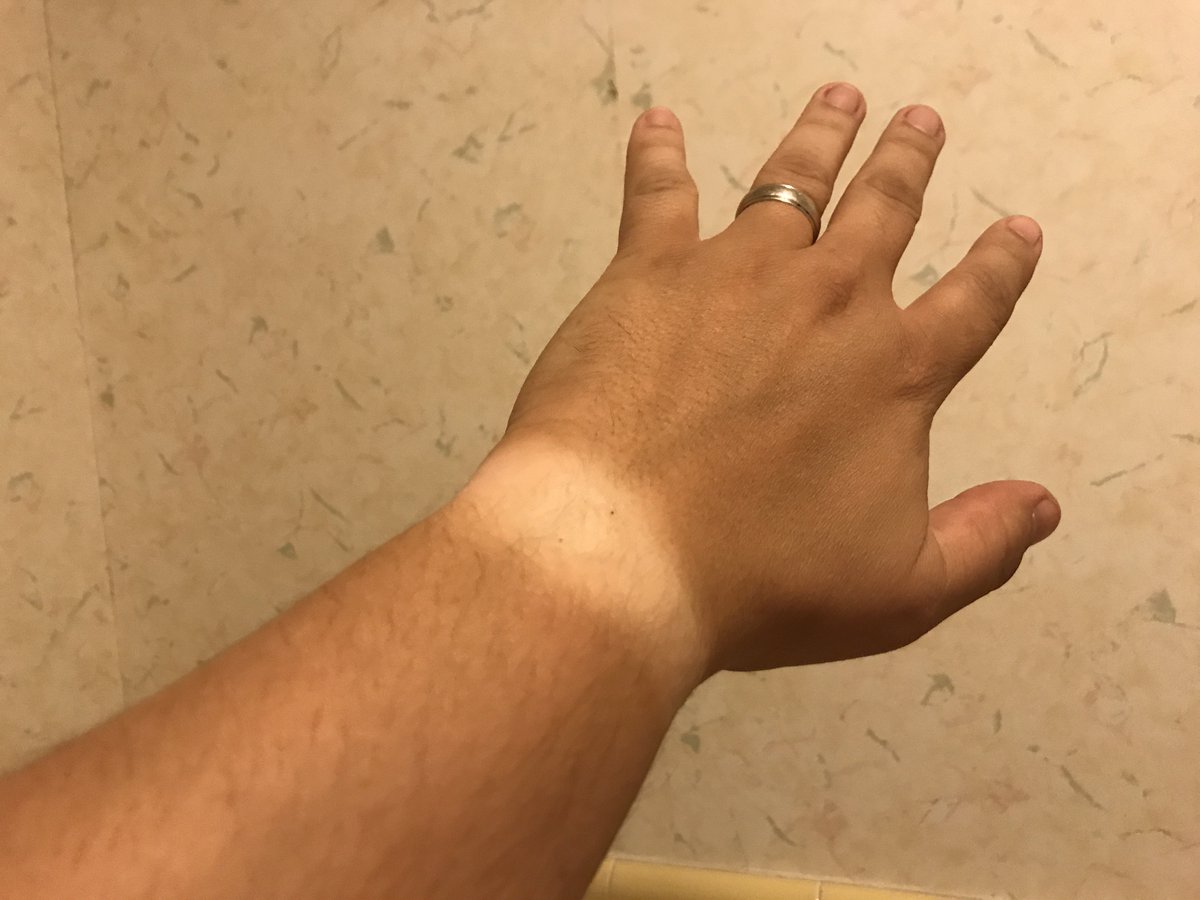 getlouder's tweet photo. How I measure my tan. #WatchLines https://t.co/51zyeOBF0O