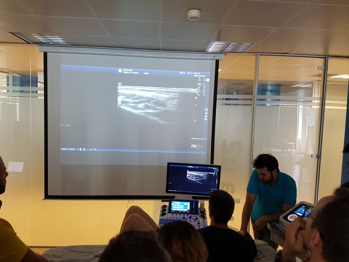 NeuroMPercut's tweet image. Tarde muy interesante en 1º sem #neuromodulación #NMPe con abordaje de nervio facial #masetero #ATM #accesorio y #elevadordelaescapula