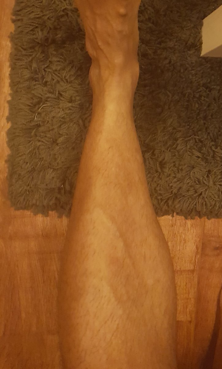 g4ogami's tweet photo. @BradleyMartyn any advice on strengthing ankles? Worried my ankle might become a weak link. #AlwaysLegDay https://t.co/rnqH8e3MkA