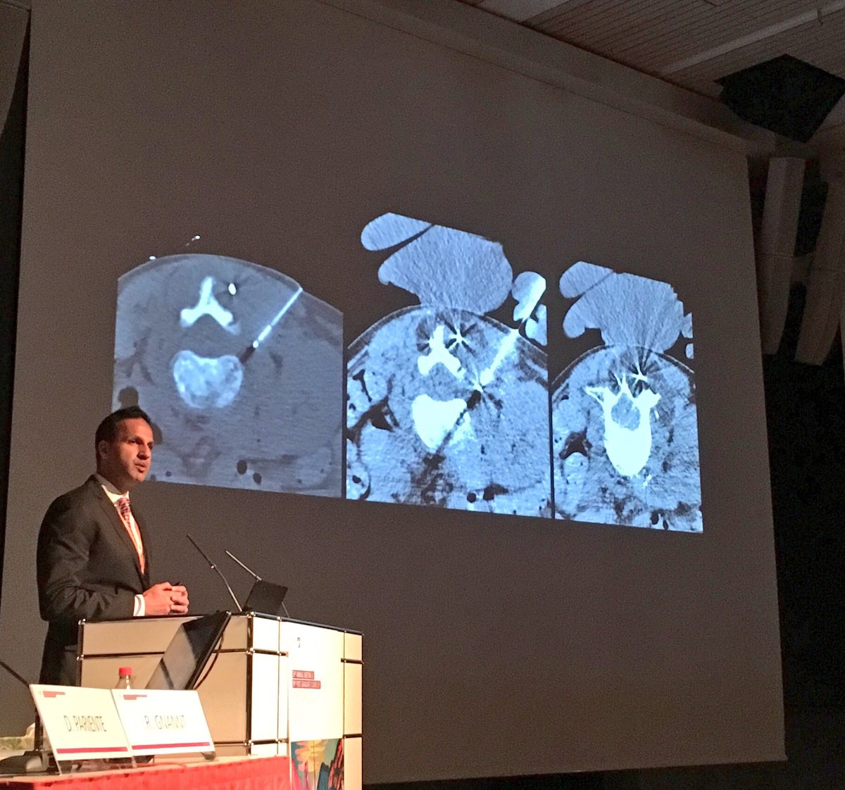 gnannt's tweet photo. Thank you guys for this great #PedsIR session D Parra, M Heran, @Premal__Patel @simonpmcguirk at this years #ESPR2017 @EurSPR @socpedsir https://t.co/BRKxCwUCn4