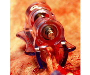 EuropeFrontier's tweet photo. Ordered 4 #ITClamp for our partners at @MedicsHomeFront. Hemorrhage control devices seal the wound edges 2 mitigate blood loss #lifesavers https://t.co/6tBPvaSZUt