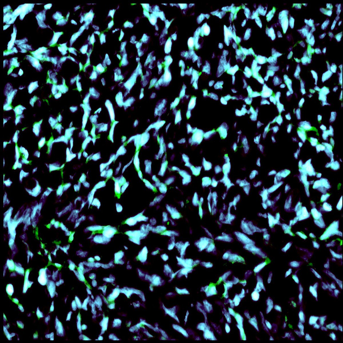 theNCI's tweet photo. What does cancer look like close up? Here are nanoparticles (green) in the nuclei (blue) of mouse brain tumor cells #cancercloseup #ASCO17 https://t.co/A2o6B4r4fK