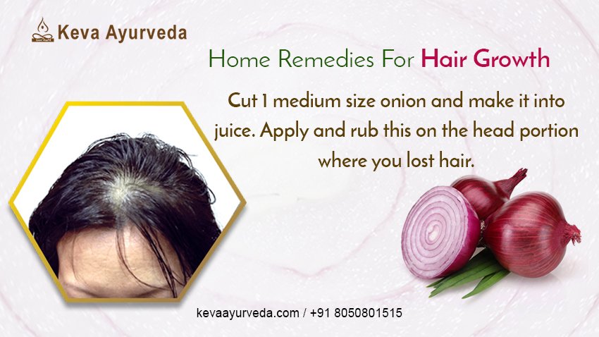 KevaAyurveda1's tweet photo. Don't be embarrassed of hairfall
Visit: https://t.co/lzSX1m6mZt | call: +91 8050801515
#ayurveda #Bangalore #hairfall #onion #juice #tips https://t.co/6b1bCNflsT