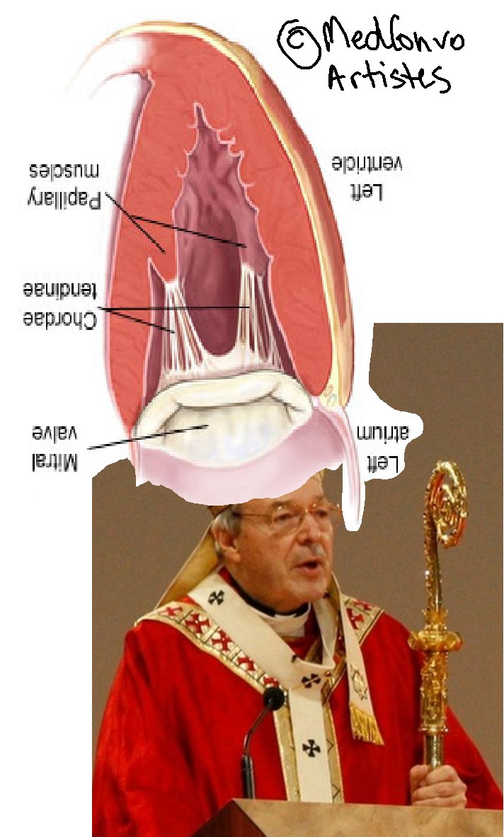 MedConversation's tweet image. And we're back! Davor and Bec regurgitate everything they know about MR. medconversations.com/?p=508