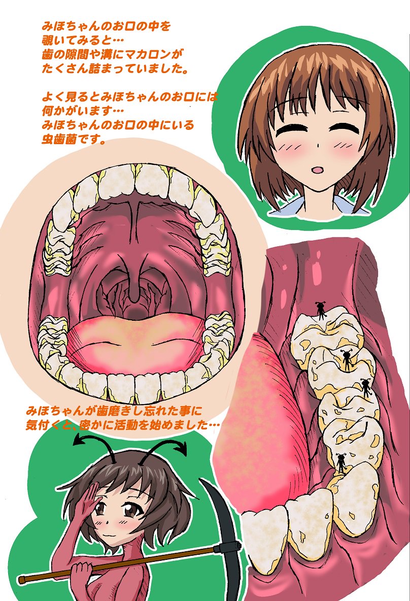 Tsubasa 最近ミニプラにハマってる さて 遅くなりましたが本日は全国の歯フェチの皆さんお待ちかねの虫歯 の日を記念して新作の虫歯絵を公開させて頂きます 幼少の頃に抱いていた 児童書の虫歯の絵がもっとリアルだったなら という長年の夢を実現させ
