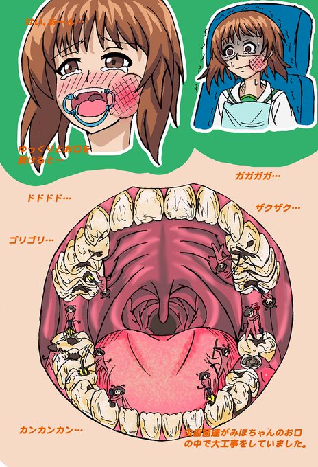 虫歯の日のtwitterイラスト検索結果