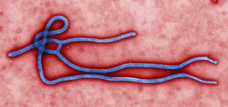 NFIDVaccines's tweet photo. NIH offers a glimpse into an #Ebola survivor’s journey to recovery https://t.co/NhWdcg4LjL https://t.co/M52NdGt4Xa